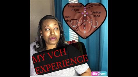 how long for vch to heal|Vertical Hood Piercing: A Beginners Guide to VCH。